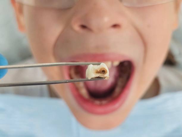 Best Emergency Dental Services for Seniors in Austell, GA