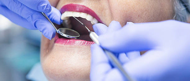 Best Emergency Root Canal Treatment in Austell, GA